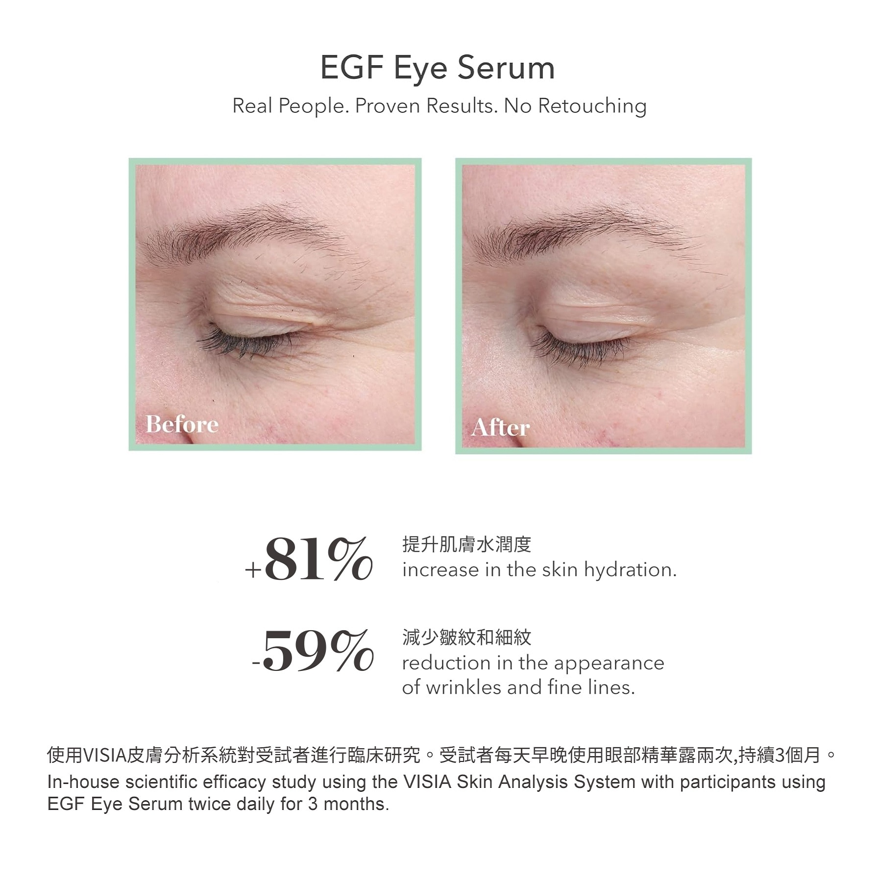 BIOEFFECT EGF EYE SERUM TRAVEL EXCLUSIVE SET｜EVA SKY SHOP